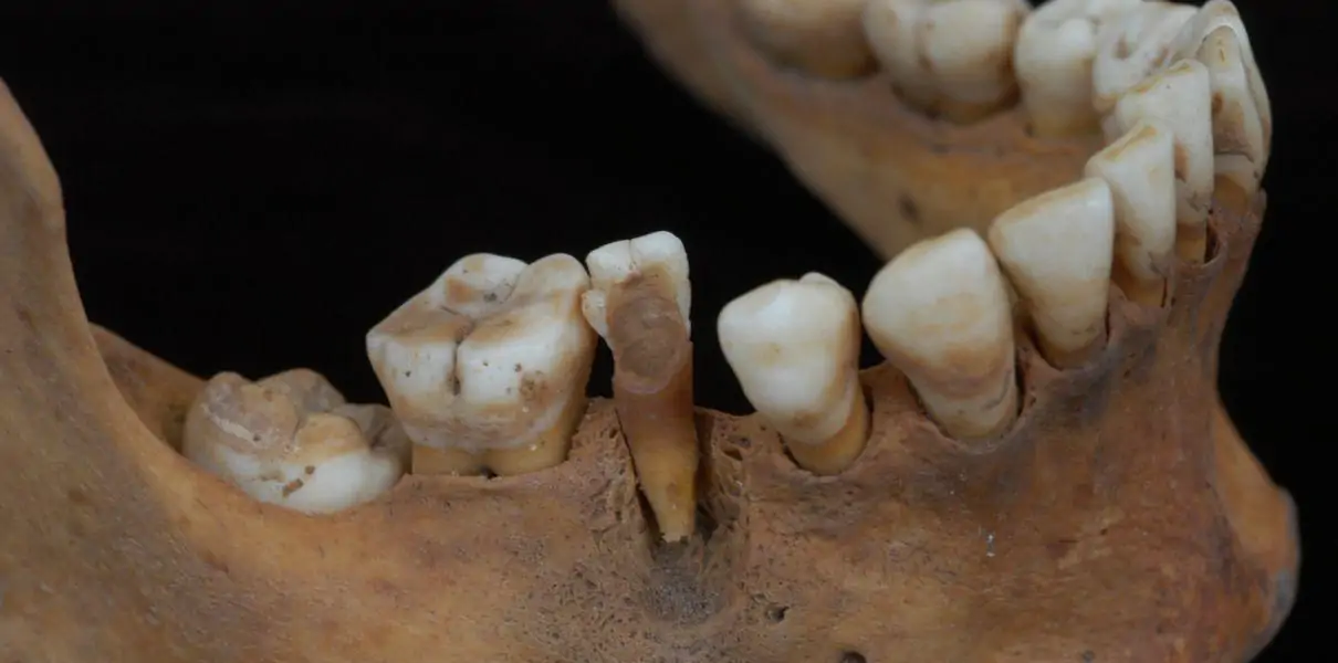 dentadura acompa&ntilde;ante se&ntilde;ora de cao