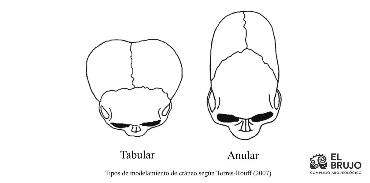 modelado craneal