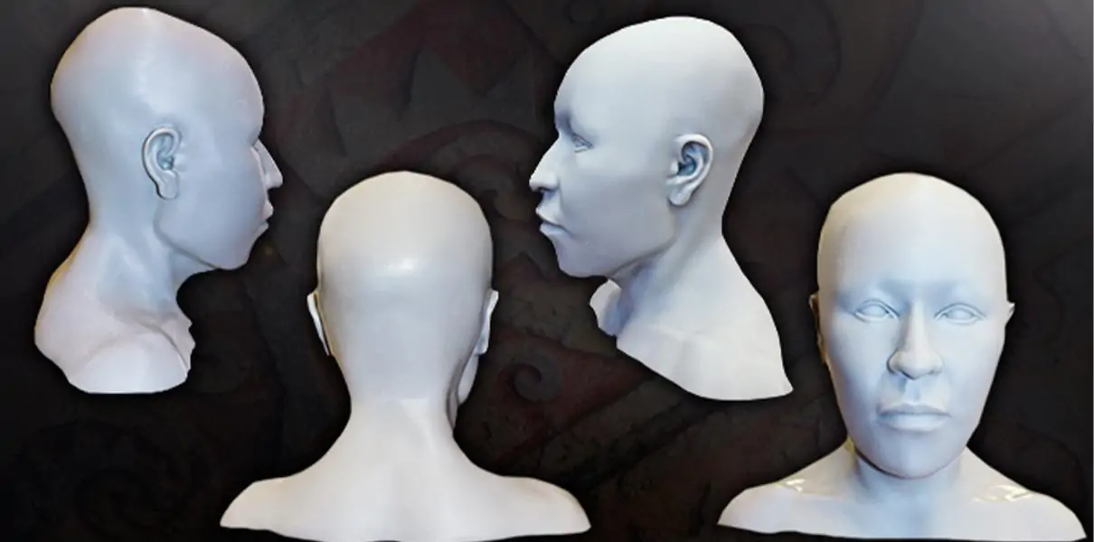 Reconstruction of The face